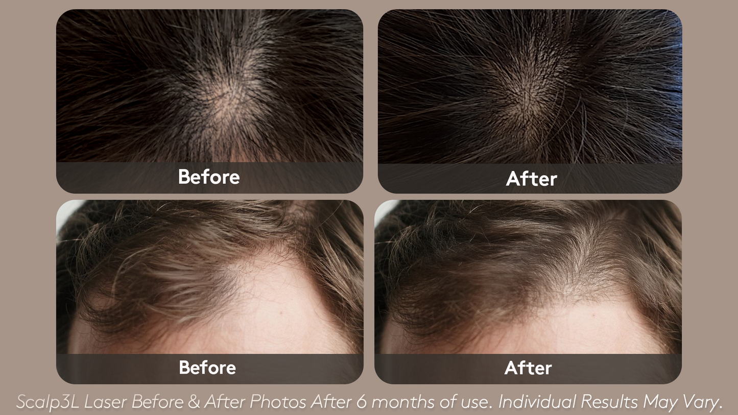 Scalp 3L