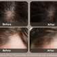 Scalp 3L